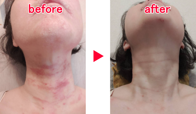 アンケート用紙